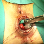 Transtar - dr. Adolfo Renzi 5