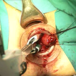 Transtar - dr. Adolfo Renzi 6