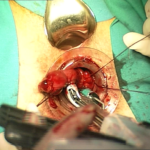Transtar - dr. Adolfo Renzi 7