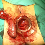 Transtar - dr. Adolfo Renzi 9