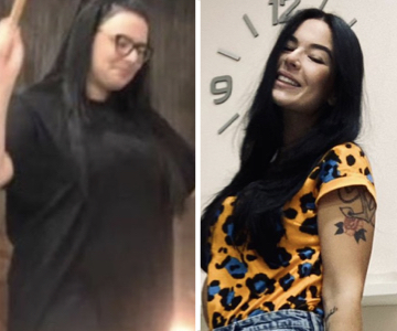 Foto pre e post bariatrica.001