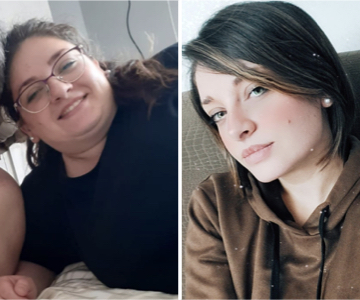 Foto pre e post bariatrica.002