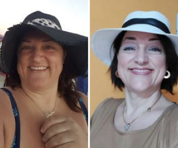 Foto pre e post bariatrica.003