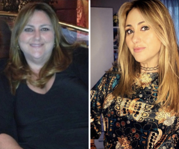 Foto pre e post bariatrica.004