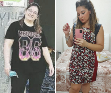 Foto pre e post bariatrica.008