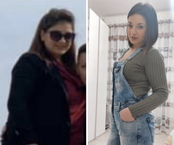 Foto pre e post bariatrica.010