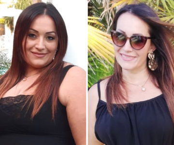 Foto pre e post bariatrica.011